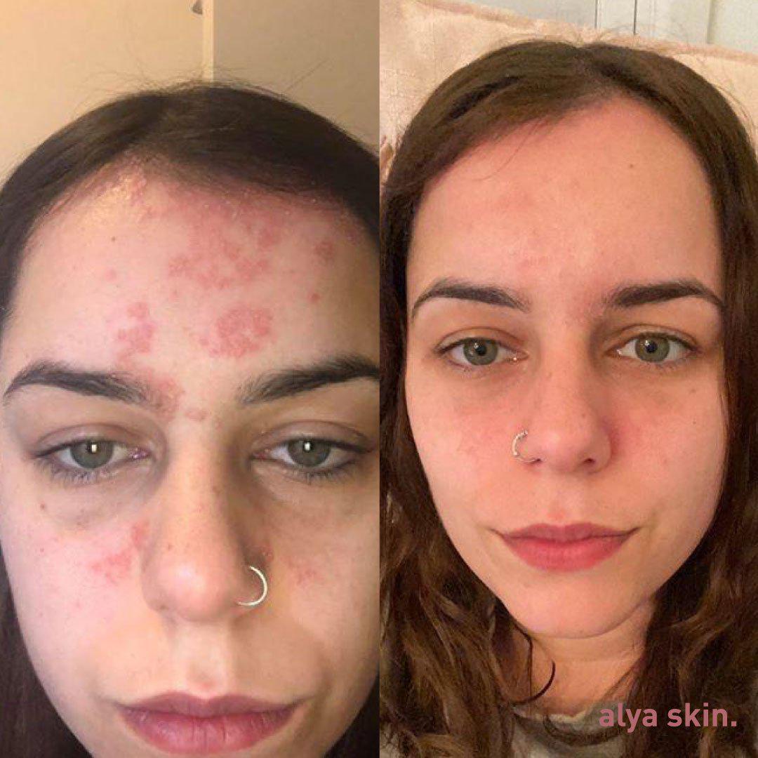 Australian Pink Clay Mask